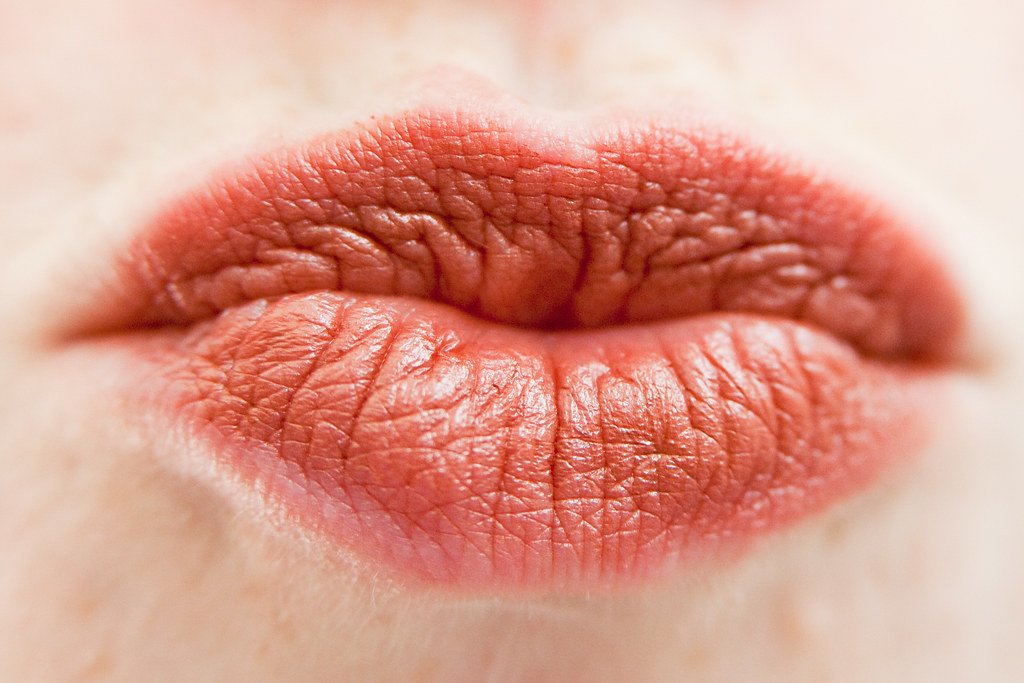 نتیجه مزوژل لب با رنگ بهتر و مرز واضحتر